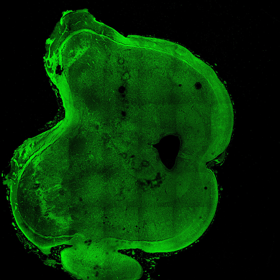 Human foetal midbrain